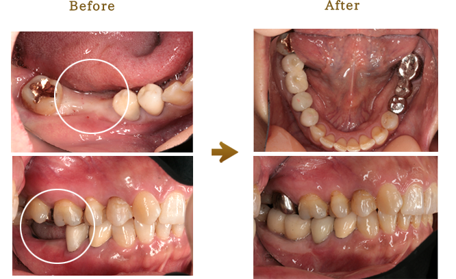 奥村歯科医院での臨床例写真
